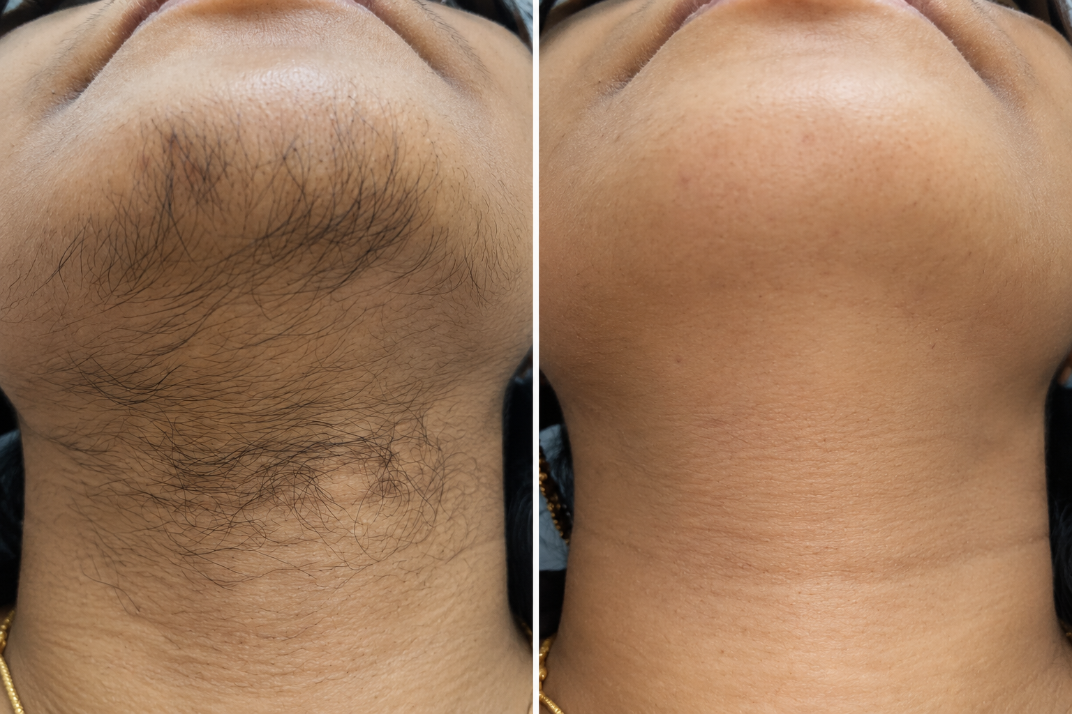 Before and after clinical clearance of